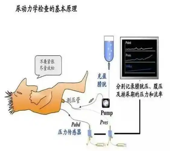 二院专家说 | 排尿的烦恼你有吗?这项新设备可以探个究竟!
