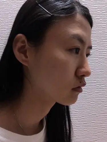 面部扁平突嘴,皮肤毛孔比较粗大本人看起来脸很小 一拍照就会显得很大