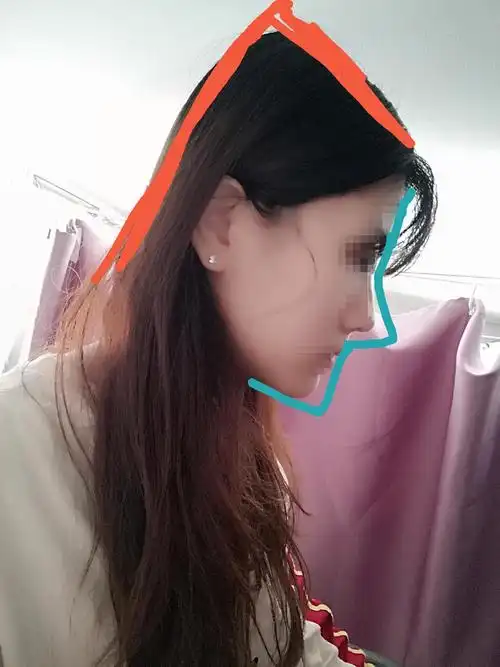 扁头尖颅顶脑门短侧脸一马平川我还有活路吗