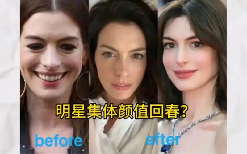 【内幕揭秘】:欧美女明星颜值集体回春的秘密是什么?