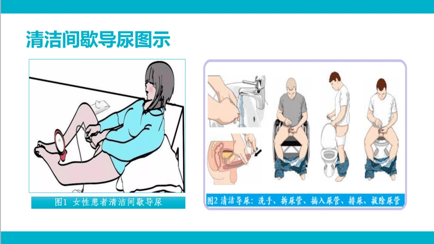 【ppt】清洁间歇导尿技术_护理_直播_微信