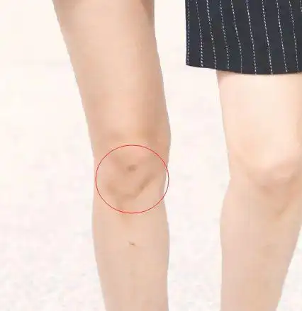 迪丽热巴现身机场难得露腿膝盖上的疤痕太抢眼粉丝心疼不忍看