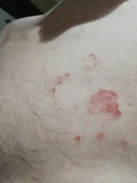 胸口这个是怎么回事?