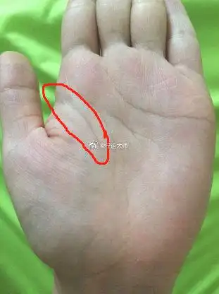 生命线很短的人不是说一定就会早死,而是生命线短的人,从小就是体弱多