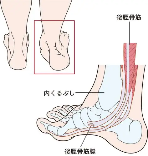 内脚踝痛疼是什么原因