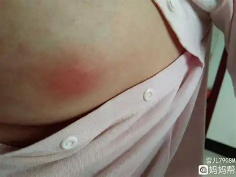 乳房有点像针扎一样的疼痛为什么