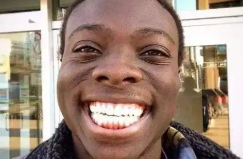 非洲人的微笑是什么梗