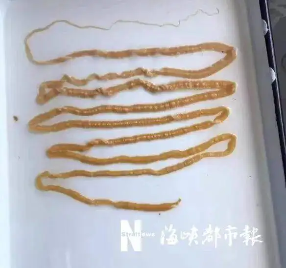 小林肚子里排出的绦虫
