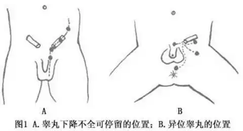 重疾投保要体检吗 重疾