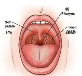 之后,由肌和黏膜组成,其后缘中央有一向下垂的突起,称为腭垂(悬雍垂)