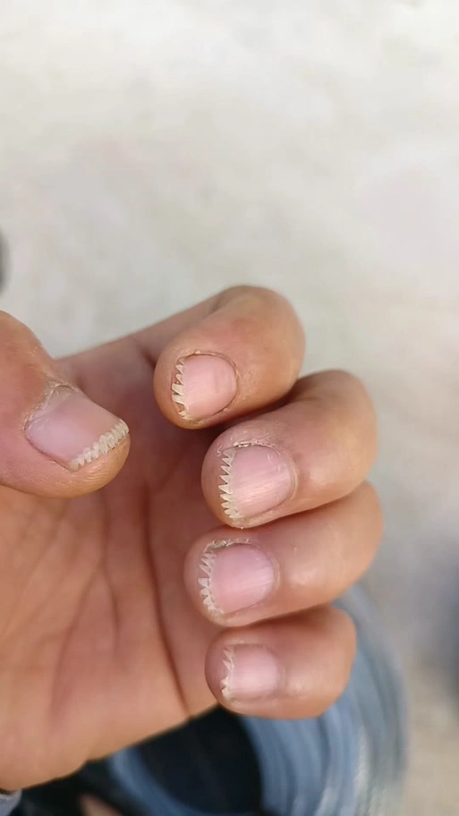 锯齿形指甲_锯齿形指甲图_锯齿形指甲搞笑说说 - 抖音