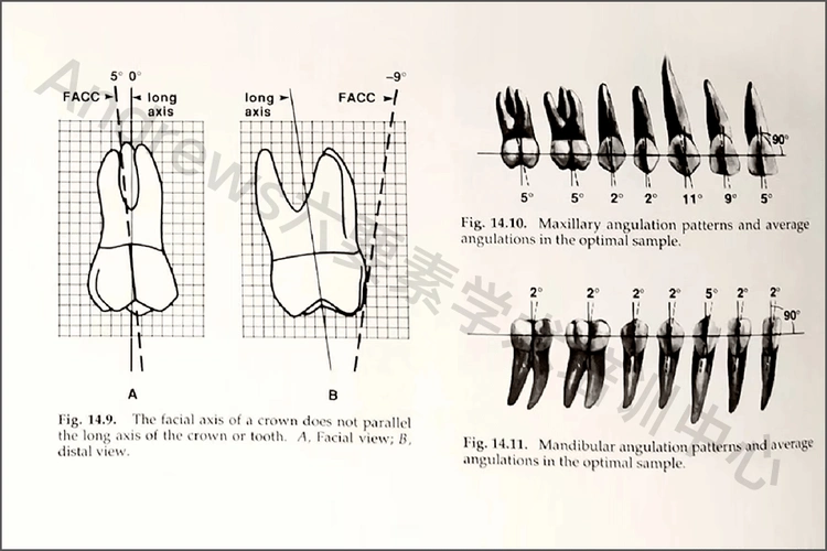 磨牙关系:上颌第一恒磨牙的远中颊尖的远中斜面与下颌第二恒磨牙的近