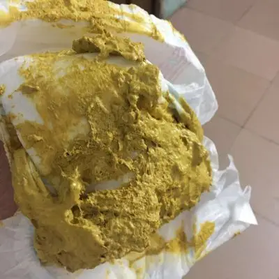 宝妈们帮我看看,宝宝会不会太干,每次大便都很用力,是怎麼回事