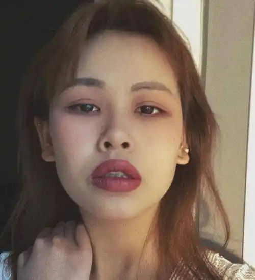 上嘴唇太厚怎么办嘴唇宽厚怎么办