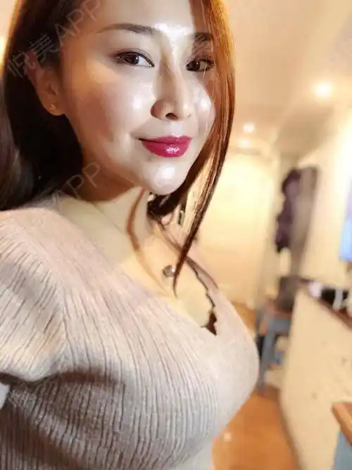 自体脂肪隆胸术后365天_其他填充术后365天_隆胸术后365天_自体脂肪术