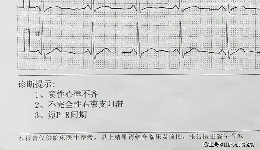 当智能手表成为健康管理神器didoe10血压心电智能手表