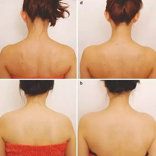 "虎背熊腰"怎么破?