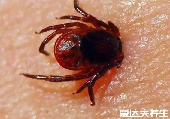 真实的蜱虫咬人后的伤口图,不小心处理也容易要人命
