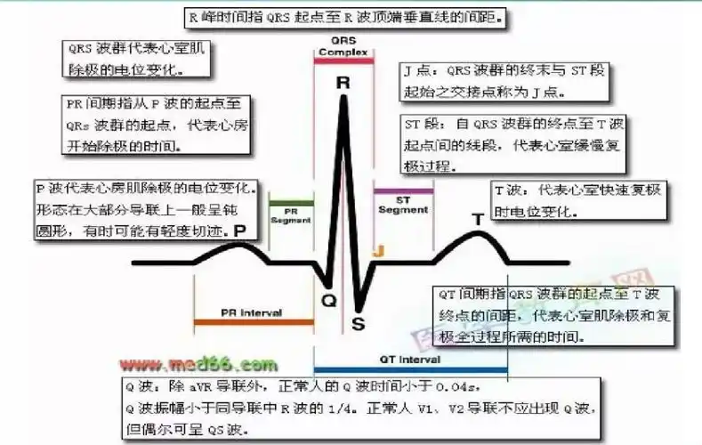 掌握这6项心电图干货,波形判断不再难!