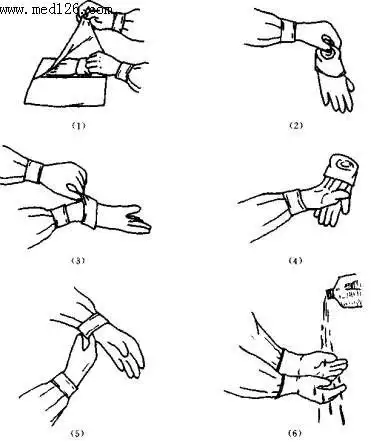 (3)戴干无菌手套:①先穿手术衣,后戴手套.