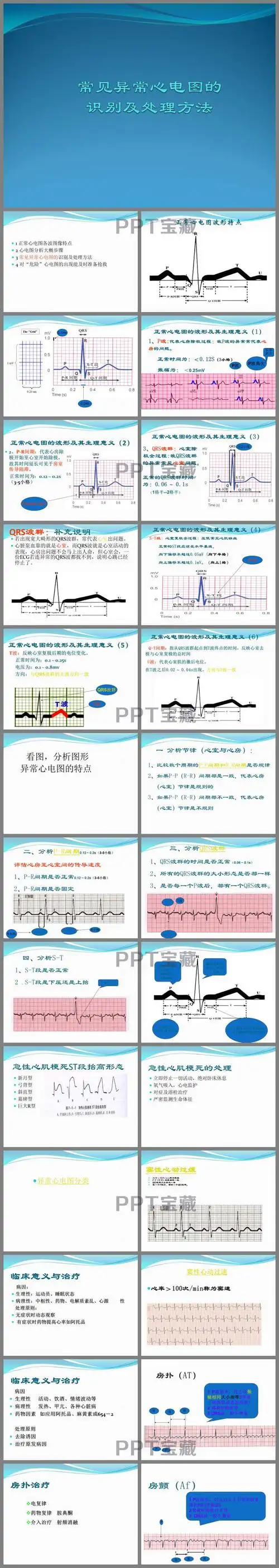 常见异常心电图的识别及处理ppt课件