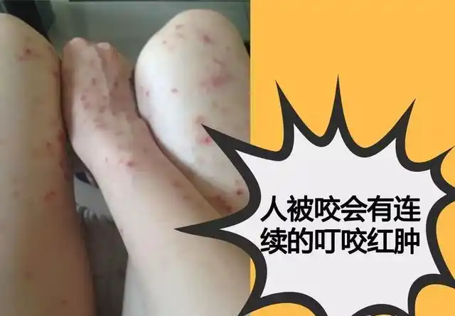 养猫的朋友们,猫虱你们是怎么解决的? - 石塘网