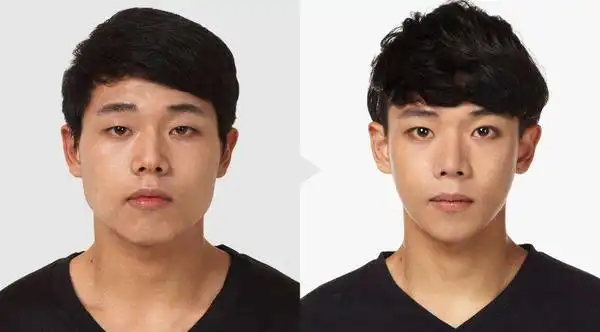 整容头条男人整形也疯狂!(前后对比照)