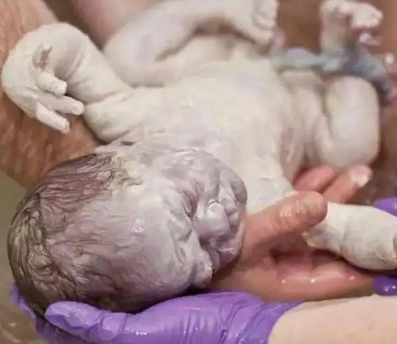 胎儿泡在羊水里,为什么不会被泡坏?