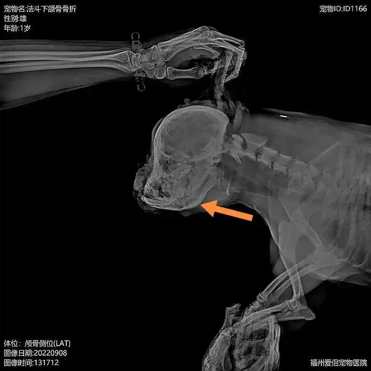 法斗下颌骨骨折多日,牙床骨的碎骨渣刺破牙龈 - 抖音