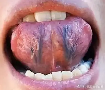 #国医的精诚力量#