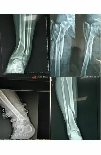 清原县人民医院骨科恭祝全县人民幸福安康