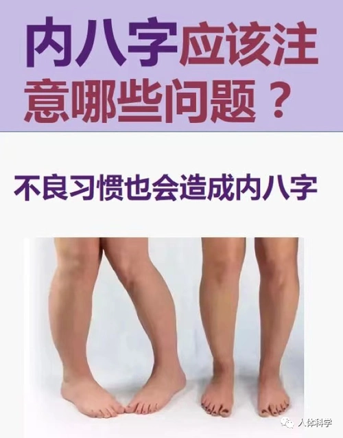 【儿童体态】不良习惯导致内八字,改善方法_腾讯新闻