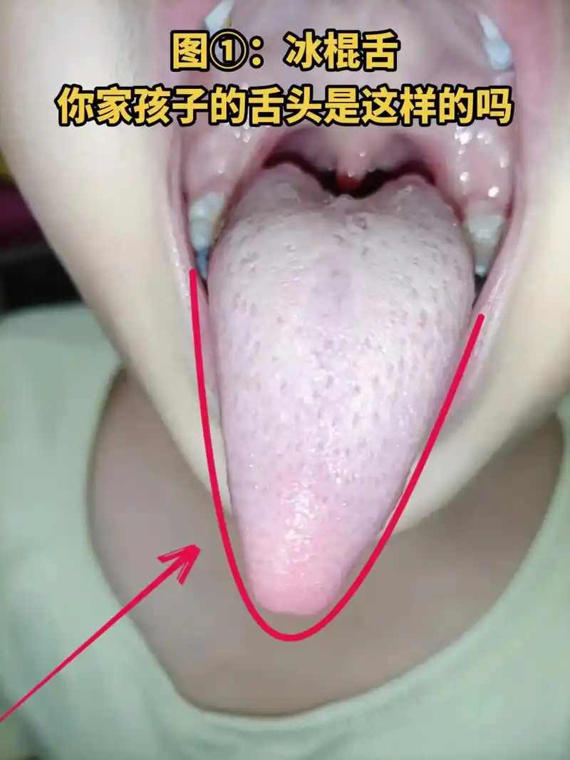 你家孩子的舌头93是这样子吗?最小的几岁,大一点的十几岁,这 - 抖音