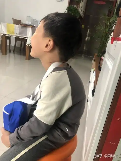 小孩子驼背,怎么办?背背佳没用!