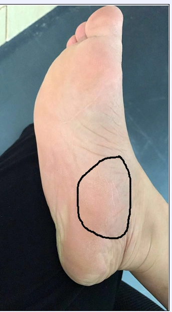 右脚掌这个部位每次早上起床走路就疼,想问去医院要挂什么科?