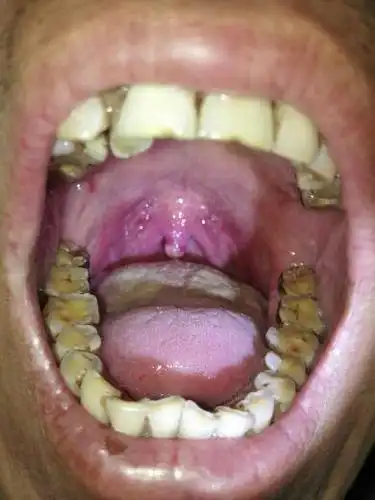 求救 求救求救 懂的医师 专家 麻烦耽误几分钟给我