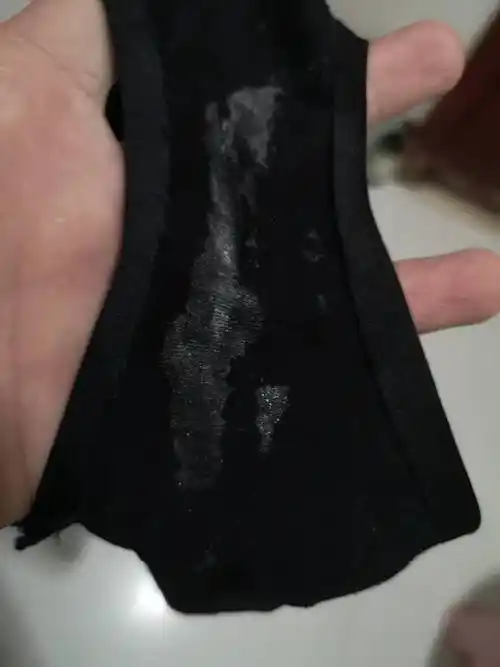 请问这是白带还是精斑