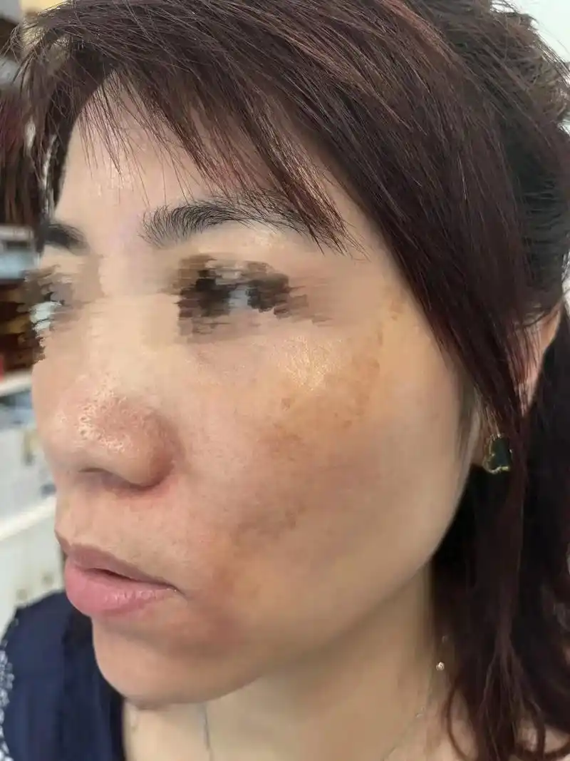 愿秋风带来更多美好每一张照片都是满满的回忆祛了混合斑瞬间年龄少10