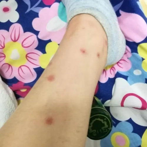 耗子的身上会带上虱子,因而要避免耗子进到房间内,塞住耗子进到房间内