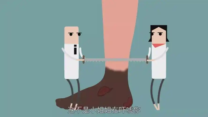 鞋子磨掉的皮,一个不起眼的鸡眼就可能发展成久治不愈的溃烂,甚至截肢