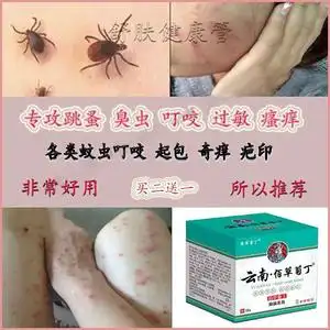 跳蚤咬蚊虫叮咬止痒消红肿药膏液臭虫蚊子咬儿童成人皮肤过敏外用