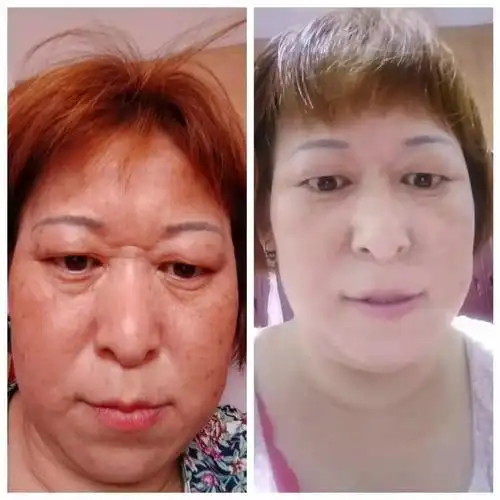 越来越多的人因为朵颜而容光焕发,只要你坚持,朵颜一定不会让你失望!