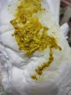 亲们 我家宝宝才一个月拉这样的粑粑正常么?