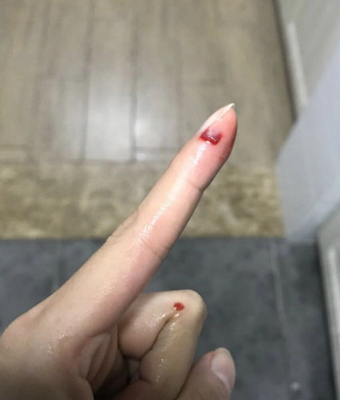 给男朋友准备爱心便当割了手,他居然对我不理不睬!是我太矫情?
