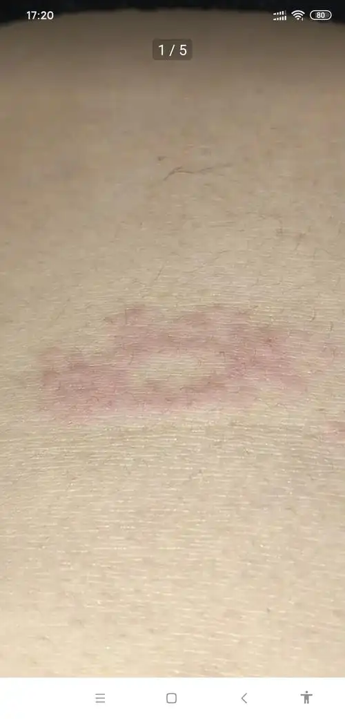 长在肚子上这是什么呀