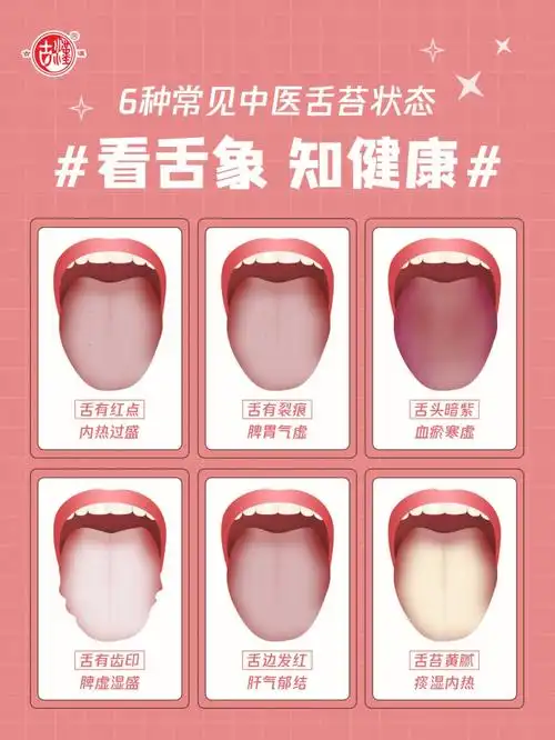 看舌象,知健康,跟着中医学舌诊,赶快自测