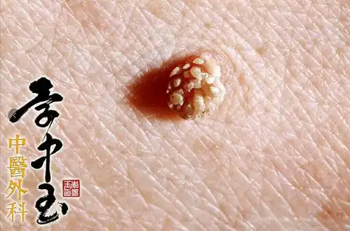 什么情况不能买重疾险