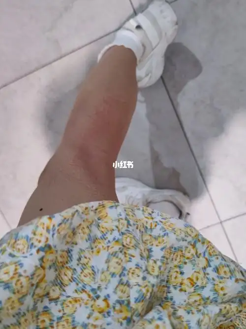 就随手拍了一下,我知道路人不会注意我蹲久了是因为吃辣条拉肚子