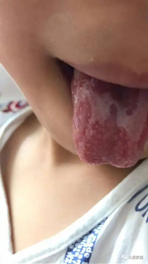 发烧便秘咳嗽地图舌