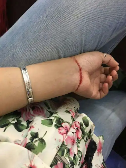 谁帮我把这张照片ps成自残的照片,带血的,严重点.谢谢